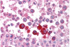 Human Testis (formalin-fixed, paraffin-embedded) stained with CHEK2 antibody ABIN213921 at 5 ug/ml followed by biotinylated goat anti-rabbit IgG secondary antibody ABIN481713, alkaline phosphatase-streptavidin and chromogen. (CHEK2 antibody  (N-Term))