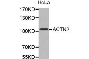 Western Blotting (WB) image for anti-Actinin, alpha 2 (ACTN2) (AA 1-250) antibody (ABIN1678557) (ACTN2 antibody  (AA 1-250))