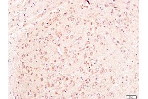 Paraformaldehyde-fixed, paraffin embedded rat brain tissue, Antigen retrieval by boiling in sodium citrate buffer(pH6) for 15min, Block endogenous peroxidase by 3% hydrogen peroxide for 30 minutes, Blocking buffer (normal goat serum) at 37°C for 20min, Antibody incubation with Rabbit Anti-Neuroglycan Polyclonal Antibody, Unconjugated  at 1:300 overnight at 4°C, followed by a conjugated secondary and DAB staining (CSPG5 antibody  (AA 351-450))