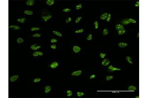 Immunofluorescence of purified MaxPab antibody to NCL on HeLa cell. (Nucleolin antibody  (AA 1-710))