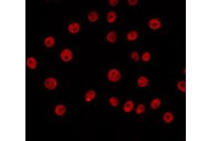 ABIN6266657 staining COS7 by IF/ICC. (SENP5 antibody)