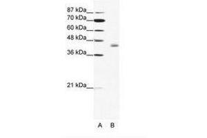 Image no. 1 for anti-LIM Domain Binding 2 (LDB2) (C-Term) antibody (ABIN202367)