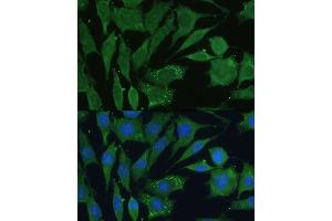 Immunofluorescence analysis of L929 cells using CGRP antibody (ABIN6128310, ABIN6137852, ABIN6137855 and ABIN6221187) at dilution of 1:100.