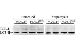 Immunoblots for LC3 protein (LC3B Antibody ) are shown for extracts from untreated or rapamycin-treated (250 nM, 4 h) cultures of wild-type (CbCln3+/+) or homozygous cerebellar cells (CbCln3Äex7/8/Äex7/8).