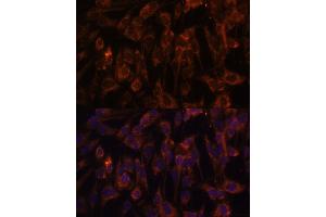 Immunofluorescence (IF) image for anti-Toll-Like Receptor 3 (TLR3) (AA 464-647) antibody (ABIN6149219)