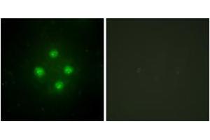 Immunofluorescence analysis of HuvEc cells, using MED24 Antibody. (MED24 antibody  (AA 801-850))