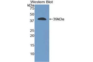 Western blot analysis of the recombinant protein. (CPB1 antibody  (AA 109-415))