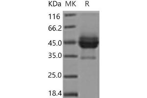 CD63 Protein (CD63) (Fc Tag)