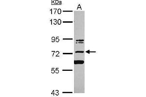 WB Image Sample (30 ug of whole cell lysate) A: Jurkat 7. (KIAA0020 antibody  (Center))