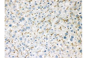 Immunohistochemistry (IHC) image for anti-ATP-Binding Cassette, Sub-Family B (MDR/TAP), Member 11 (ABCB11) (AA 1175-1199), (C-Term) antibody (ABIN3043733)