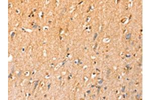 The image on the left is immunohistochemistry of paraffin-embedded Human brain tissue using ABIN7192442(SLC25A3 Antibody) at dilution 1/35, on the right is treated with synthetic peptide. (SLC25A3 antibody)