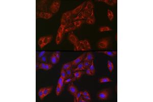 Immunofluorescence analysis of U-2 OS cells using FBP1 Rabbit pAb (ABIN6130385, ABIN6140501, ABIN6140502 and ABIN6221054) at dilution of 1:100 (40x lens). (FBP1 antibody  (AA 1-338))