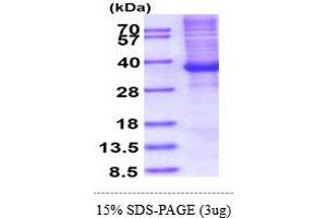 SDS-PAGE (SDS) image for Homeobox B13 (HOXB13) (AA 1-284) protein (His tag) (ABIN5853367) (HOXB13 Protein (AA 1-284) (His tag))