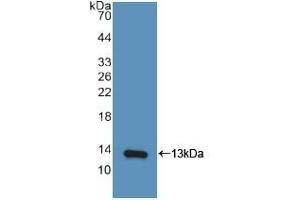 Detection of Recombinant IP10, Human using Polyclonal Antibody to Interferon Gamma Induced Protein 10 kDa (IP10) (CXCL10 antibody  (AA 22-98))