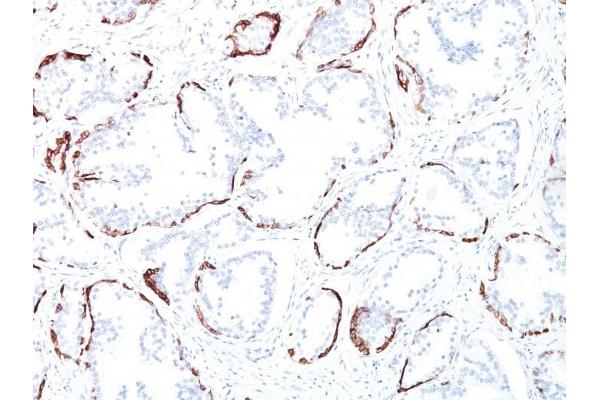 Cytokeratin 2 antibody