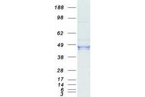 Western Blotting (WB) image for Dual Specificity Phosphatase 6 (DUSP6) (Transcript Variant 1) protein (Myc-DYKDDDDK Tag) (ABIN2719840)