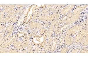 Detection of CD40L in Human Kidney Tissue using Monoclonal Antibody to Cluster Of Differentiation 40 Ligand (CD40L) (CD40 Ligand antibody  (AA 48-244))