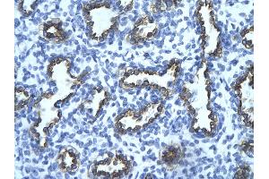 Human Lung; . (TRIM13 antibody  (Middle Region))