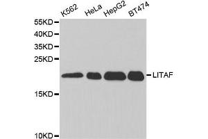 Western Blotting (WB) image for anti-Lipopolysaccharide-Induced Tumor Necrosis Factor-alpha Factor (LITAF) antibody (ABIN1876657) (LITAF antibody)