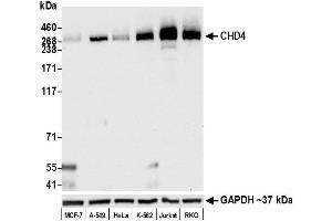 anti-Chromodomain Helicase DNA Binding Protein 4 (CHD4) (AA 50-100) antibody