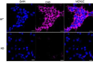 Immunocytochemical staining of HeLa cells using CAD antibody (ABIN7797866), 1:1,000), Top panel: wild-type (WT), Bottom panal: CAD shRNA knockdown (KD). (Recombinant CAD antibody)