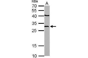 Western Blotting (WB) image for anti-NAD(P)H Dehydrogenase, Quinone 1 (NQO1) (C-Term) antibody (ABIN2854666)