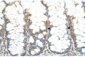 Human Intestine (CHIC2 antibody  (N-Term))