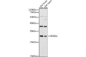 Western blot analysis of extracts of various cell lines, using INSIG2 antibody (ABIN7267888) at 1:1000 dilution. (INSIG2 antibody  (AA 50-150))