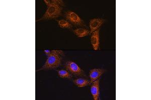 Immunofluorescence analysis of NIH/3T3 cells using NPB Rabbit pAb (ABIN7268885) at dilution of 1:100. (Neuropeptide B antibody  (AA 1-125))