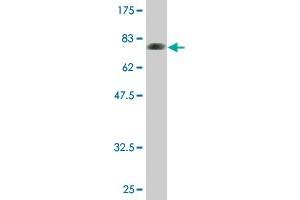 Western Blot detection against Immunogen (77. (CAP1 antibody  (AA 1-475))