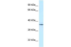 WB Suggested Anti-NUDT6 Antibody Titration: 1. (NUDT6 antibody  (Middle Region))