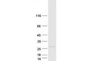 Western Blotting (WB) image for Exosome Component 1 (EXOSC1) protein (Myc-DYKDDDDK Tag) (ABIN2720621)