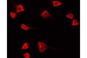 ABIN6266909 staining HT29 by IF/ICC. (TUBGCP5 antibody  (Internal Region))