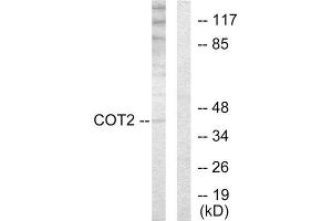 Western Blotting (WB) image for anti-Grr1p (GRR1) (N-Term) antibody (ABIN1849262) (Grr1p antibody  (N-Term))