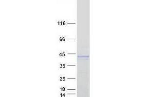 Western Blotting (WB) image for ADP-Ribosyltransferase 5 (ART5) (Transcript Variant 2) protein (Myc-DYKDDDDK Tag) (ABIN2714950)