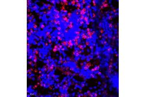 Immunofluorescence of paraffin embedded mouse bone using CD177 (ABIN7073372) at dilution of 1:500 (400x lens) (CD177 antibody)