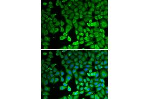 Immunofluorescence analysis of U2OS cells using NR4A1 antibody (ABIN6293398).