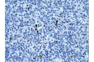 Image no. 1 for anti-Annexin A3 (ANXA3) (N-Term) antibody (ABIN202243) (Annexin A3 antibody  (N-Term))