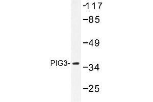 Image no. 1 for anti-Tumor Protein P53 Inducible Protein 3 (TP53I3) antibody (ABIN272242) (TP53I3 antibody)