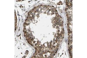 Immunohistochemical staining (Formalin-fixed paraffin-embedded sections) of human testis with OS9 polyclonal antibody  shows strong positivity in spermatogenic cells at 1:200-1:500 dilution. (OS9 antibody)