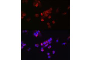 Immunofluorescence analysis of HepG2 cells using FGF23 antibody (ABIN6127894, ABIN6140600, ABIN6140602 and ABIN6221721) at dilution of 1:25. (FGF23 antibody  (AA 25-251))