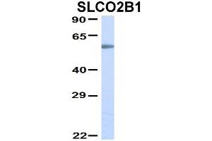 Western Blotting (WB) image for anti-Solute Carrier Organic Anion Transporter Family, Member 2B1 (SLCO2B1) (N-Term) antibody (ABIN2781627)