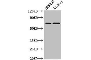 Western Blot Positive WB detected in: HEK293 whole cell lysate, Mouse kidney tissue All lanes: RABGGTA antibody at 1. (RABGGTA antibody  (AA 1-200))