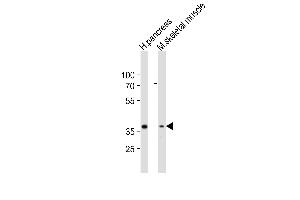Western blot analysis of lysates from human pancreas, mouse skeletal muscle tissue lysate (from left to right), using B4GALT7 Antibody (C-term) (ABIN6243577 and ABIN6577900). (B4GALT7 antibody  (C-Term))