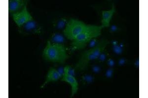 Anti-KLHL2 mouse monoclonal antibody (ABIN2453210) immunofluorescent staining of COS7 cells transiently transfected by pCMV6-ENTRY KLHL2 (RC205347). (KLHL2 antibody  (AA 1-100, AA 494-593))