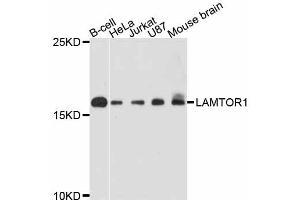 Western blot analysis of extracts of various cell lines, using LAMTOR1 antibody. (LAMTOR1 antibody)