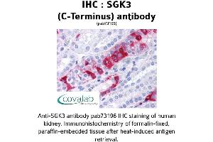 Image no. 1 for anti-serum/glucocorticoid Regulated Kinase Family, Member 3 (SGK3) (C-Term) antibody (ABIN1739226) (SGK3 antibody  (C-Term))