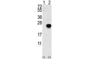 Western blot analysis of FGF1 antibody and 293 cell lysate (2 ug/lane) either nontransfected (Lane 1) or transiently transfected with the FGF1 gene (2). (FGF1 antibody  (AA 5-30))