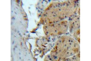 Used in DAB staining on fromalin fixed paraffin-embedded Stomach tissue (SIRT2 antibody  (AA 65-340))