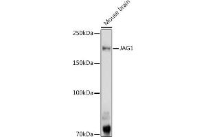 Western blot analysis of extracts of Mouse brain, using J antibody (ABIN6129289, ABIN6142633, ABIN6142635 and ABIN6216495) at 1:1000 dilution.